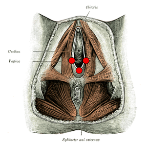 Vulvar Vestibulitis Syndrome