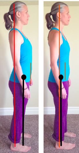 Standing alignment: loading the forefoot creates excessive pressure, nerve irritation and inflammation