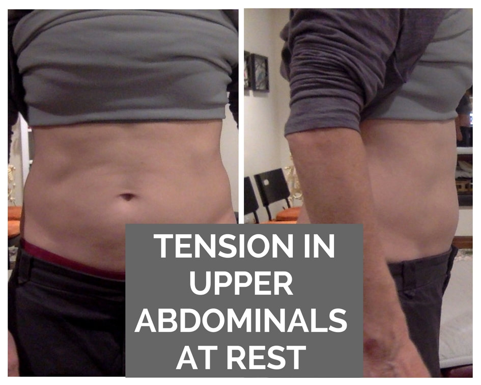 Tension in the upper abdominals at rest